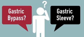 gastric sleeve vs gastric bypass